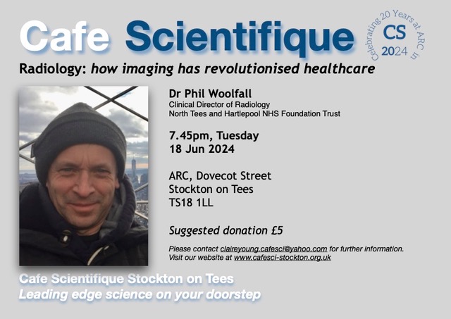 A white male wearing a black beanie hat. He is wearing a hoodie and a coat which are dark. The background shows a landscape and you can see metal railings. Café Scientifique: Radiology: how imaging has revolutionised healthcare